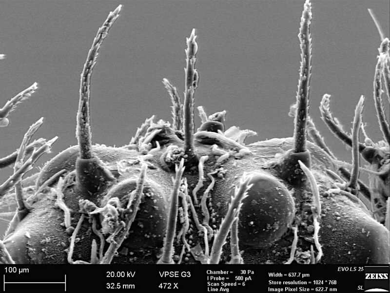 Monstruosités au microscope monstruosites au microscope 20 araignee monstruosites-au-microscope-20-araignee