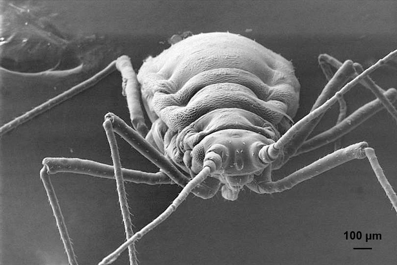 Monstruosités au microscope monstruosites au microscope 21 puceron monstruosites-au-microscope-21-puceron