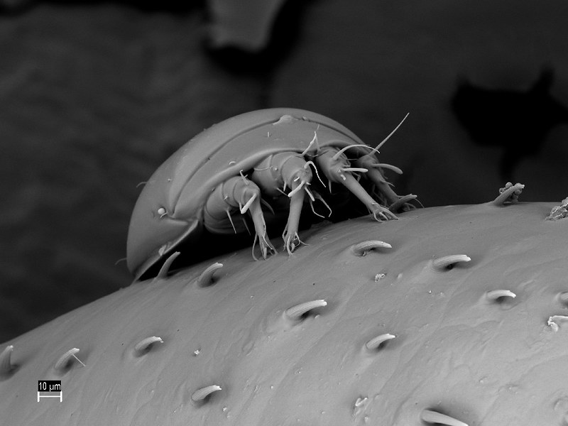 Monstruosités au microscope monstruosites au microscope 22 mite mille patte monstruosites-au-microscope-22-mite-mille-patte