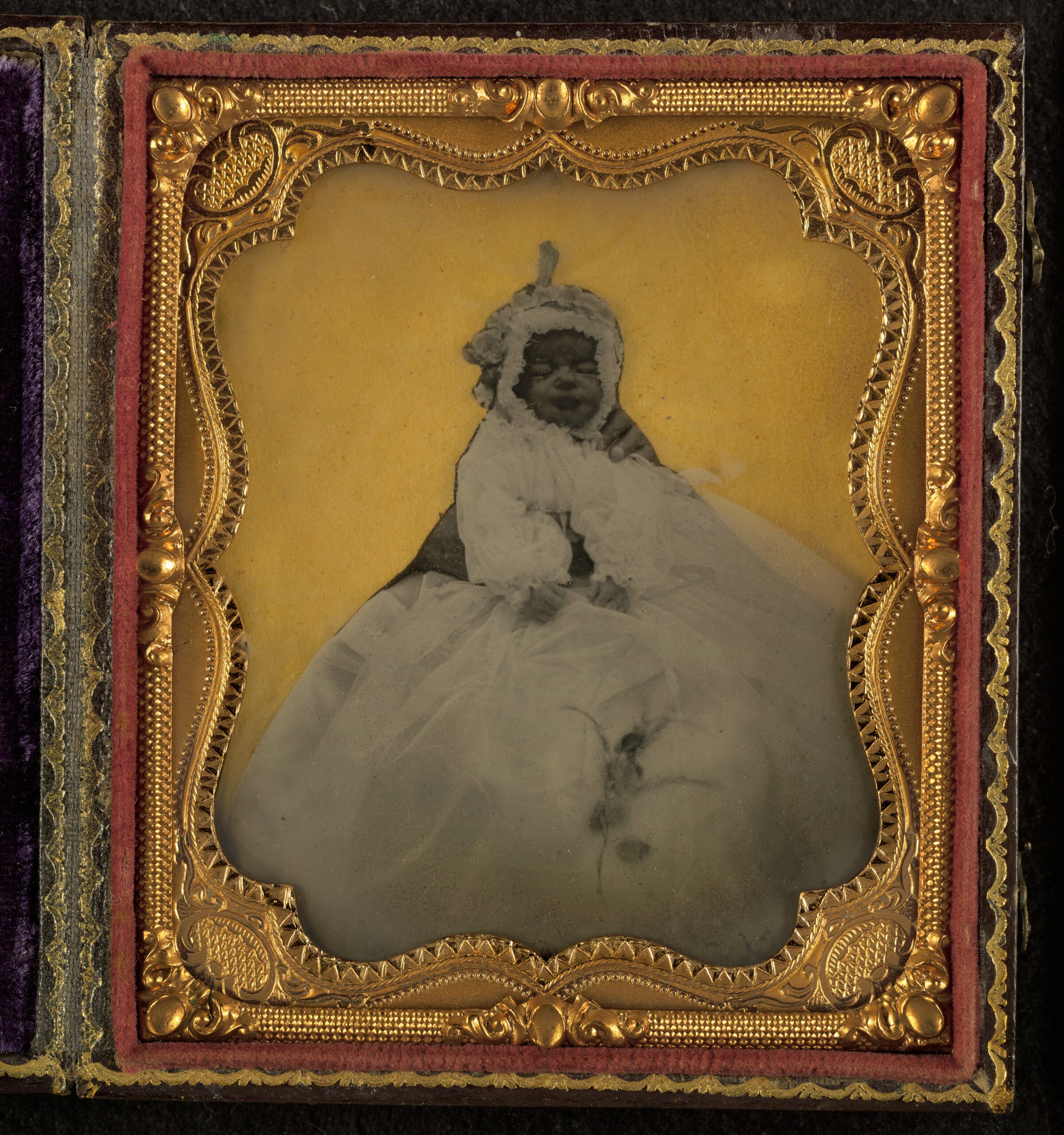 Parent effacé d'un portrait ancien mais main encore visible Portrait de bébé vers 1862-1867 dont le parent a été effacé mais dont la main reste visible