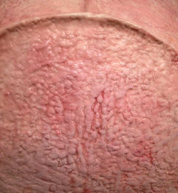 La tente Zombie de Andrea Hasler tente en intestin de andrea hasler tente zombie 6 tente-en-intestin-de-andrea-hasler-tente-zombie-6