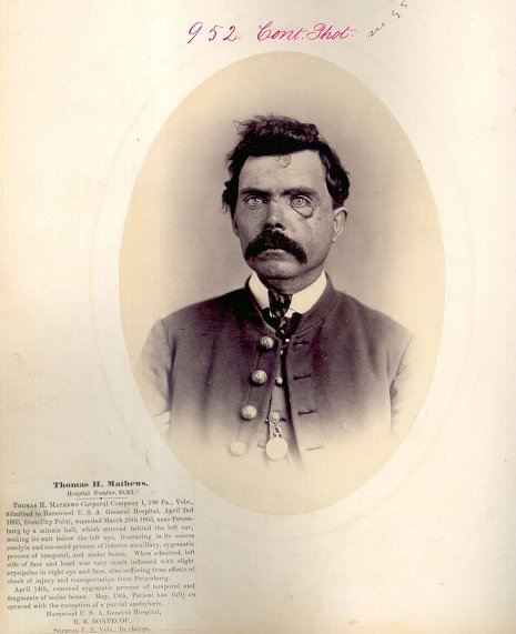 Portraits de vétérans blessés durant la guerre de Sécession portraits de veterans blesses amputes durant la guerre de secession 8 portraits-de-veterans-blesses-amputes-durant-la-guerre-de-secession-8