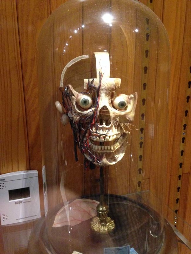 Le Mutter museum ou le musée des horreurs médicales Le Mutter museum ou le musee des horreurs medicales 6 Le-Mutter-museum-ou-le-musee-des-horreurs-medicales-6