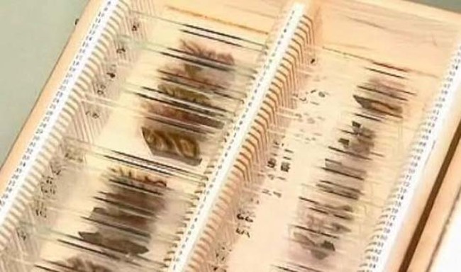 Le Mutter museum ou le musée des horreurs médicales mutter museum tranches de cerveau albert einstein mutter-museum-tranches-de-cerveau-albert-einstein