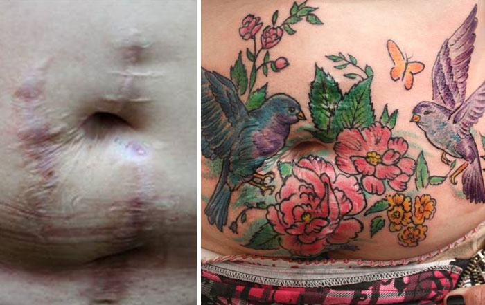 Les tatouages sur des cicatrices des victimes de violence domestique tatouages sur des cicatrices des victimes de violence domestique par Flavia Carvalho 5 tatouages-sur-des-cicatrices-des-victimes-de-violence-domestique-par-Flavia-Carvalho-5