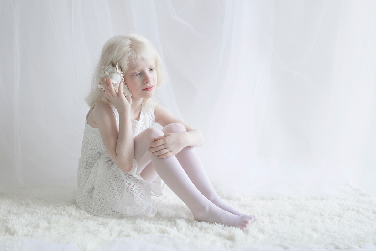 L'étrange beauté porcelaine des albinos par Yulia Taits l etrange beaute porcelaine des albinos avec ces portraits magnifiques de personnes atteintes d albinisme par Yulia Taits 10 l-etrange-beaute-porcelaine-des-albinos-avec-ces-portraits-magnifiques-de-personnes-atteintes-d-albinisme-par-Yulia-Taits-9