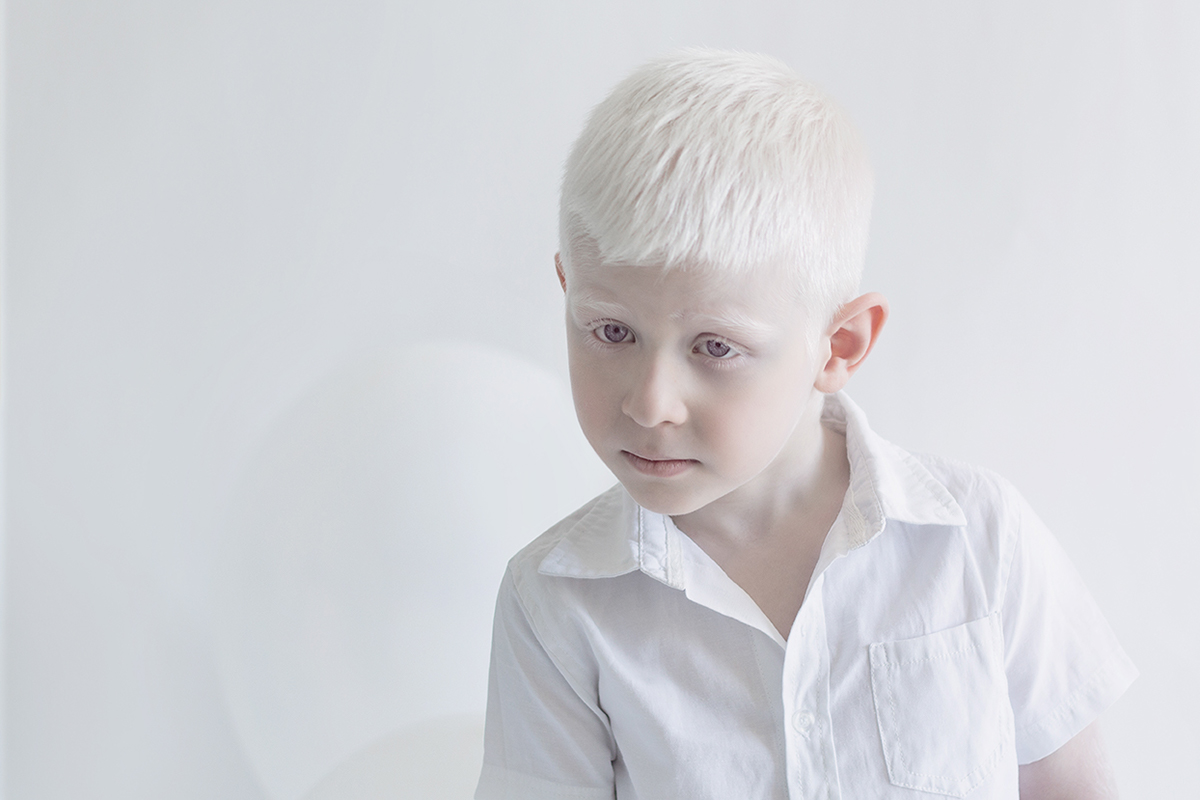 L'étrange beauté porcelaine des albinos par Yulia Taits l etrange beaute porcelaine des albinos avec ces portraits magnifiques de personnes atteintes d albinisme par Yulia Taits 9 l-etrange-beaute-porcelaine-des-albinos-avec-ces-portraits-magnifiques-de-personnes-atteintes-d-albinisme-par-Yulia-Taits-8