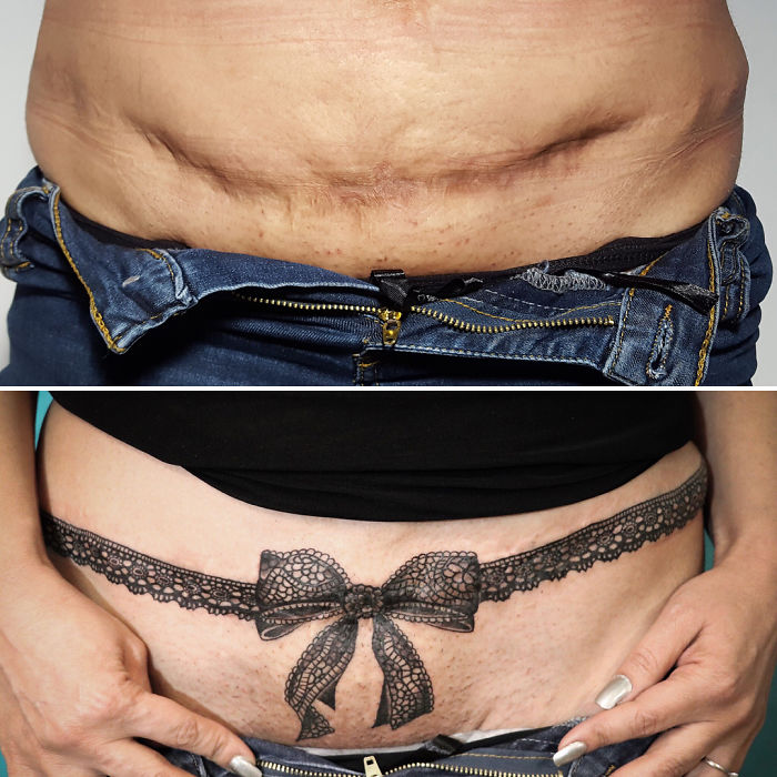 50 géniaux tatouages de cicatrices ou de marques de naissance 50 geniaux tatouages de cicatrices ou de marques de naissance 33 50-geniaux-tatouages-de-cicatrices-ou-de-marques-de-naissance-33