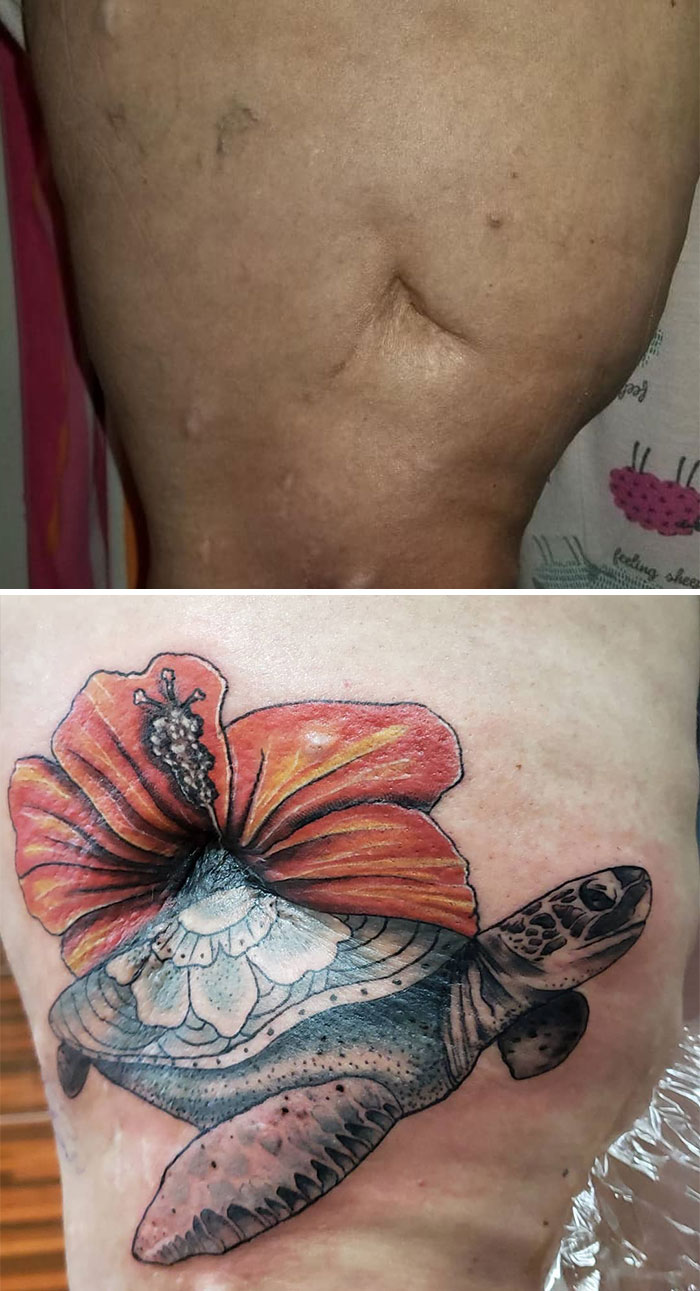 50 géniaux tatouages de cicatrices ou de marques de naissance 50 geniaux tatouages de cicatrices ou de marques de naissance 38 50-geniaux-tatouages-de-cicatrices-ou-de-marques-de-naissance-38