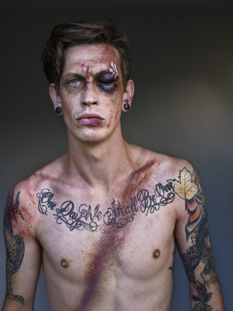 Des portraits de survivants d'accidents grace à la ceinture de sécurité Des portraits de survivants d accidents grace a la ceinture de securite 4 Des-portraits-de-survivants-d-accidents-grace-a-la-ceinture-de-securite-4