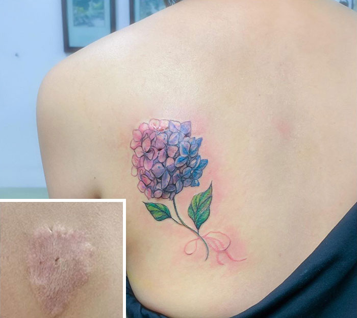 30 recouvrements de cicatrices par des tatouages par Tran Bich Ngoc 30 recouvrements de cicatrices par des tatouages par Tran Bich Ngoc 15 30-recouvrements-de-cicatrices-par-des-tatouages-par-Tran-Bich-Ngoc-15