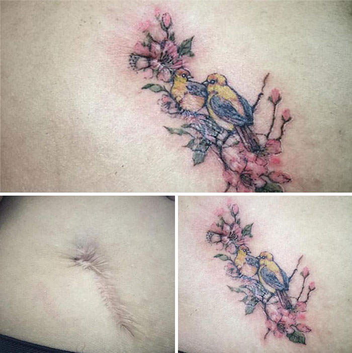 30 recouvrements de cicatrices par des tatouages par Tran Bich Ngoc 30 recouvrements de cicatrices par des tatouages par Tran Bich Ngoc 28 30-recouvrements-de-cicatrices-par-des-tatouages-par-Tran-Bich-Ngoc-28