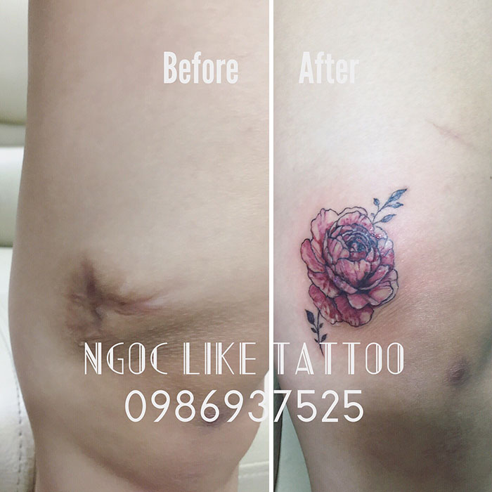 30 recouvrements de cicatrices par des tatouages par Tran Bich Ngoc 30 recouvrements de cicatrices par des tatouages par Tran Bich Ngoc 30 30-recouvrements-de-cicatrices-par-des-tatouages-par-Tran-Bich-Ngoc-30