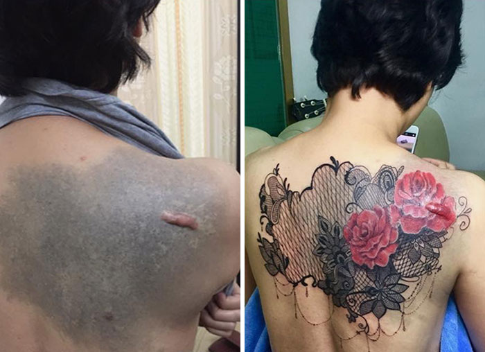 30 recouvrements de cicatrices par des tatouages par Tran Bich Ngoc 30 recouvrements de cicatrices par des tatouages par Tran Bich Ngoc 4 30-recouvrements-de-cicatrices-par-des-tatouages-par-Tran-Bich-Ngoc-4