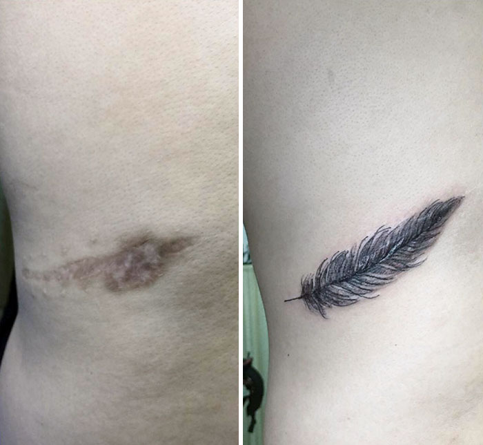 30 recouvrements de cicatrices par des tatouages par Tran Bich Ngoc 30 recouvrements de cicatrices par des tatouages par Tran Bich Ngoc 6 30-recouvrements-de-cicatrices-par-des-tatouages-par-Tran-Bich-Ngoc-6