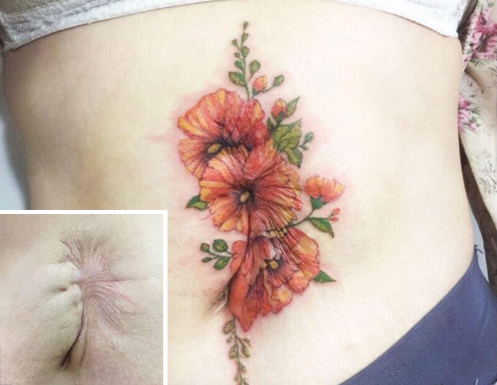 30 recouvrements de cicatrices par des tatouages par Tran Bich Ngoc 30 recouvrements de cicatrices par des tatouages par Tran Bich Ngoc 7 30-recouvrements-de-cicatrices-par-des-tatouages-par-Tran-Bich-Ngoc-7