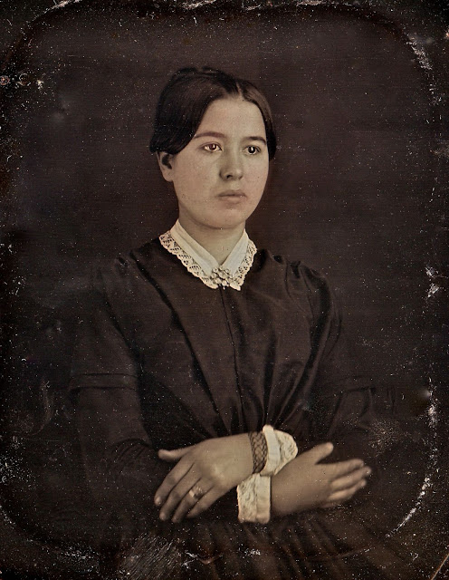 Des portraits de Charlotte Bronson avant et avec la tuberculose Des portraits de Charlotte Bronson avant et avec la tuberculose 1 Des-portraits-de-Charlotte-Bronson-avant-et-avec-la-tuberculose-1