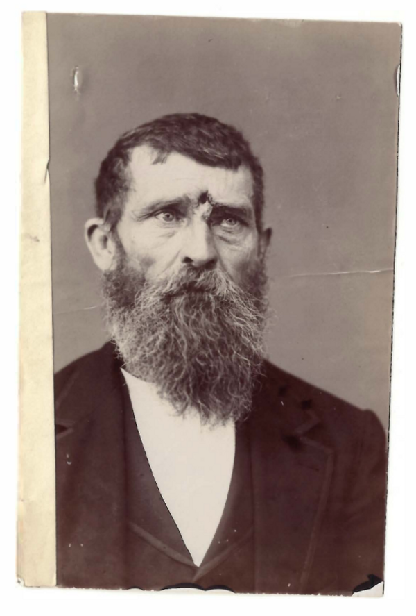 jacob miller center shot blessure front Portrait attribué à Jacob Miller, vétéran blessé au front à Chickamauga en 1863