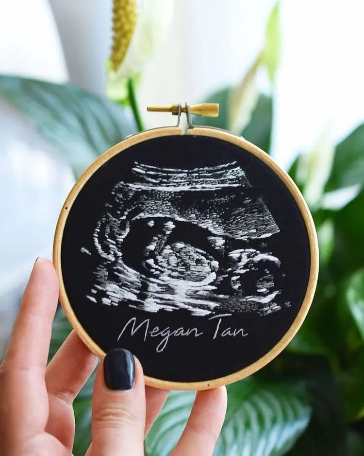 Des broderies d'échographies Des broderies d echographies bebe ultrason 3 Des-broderies-d-echographies-bebe-ultrason