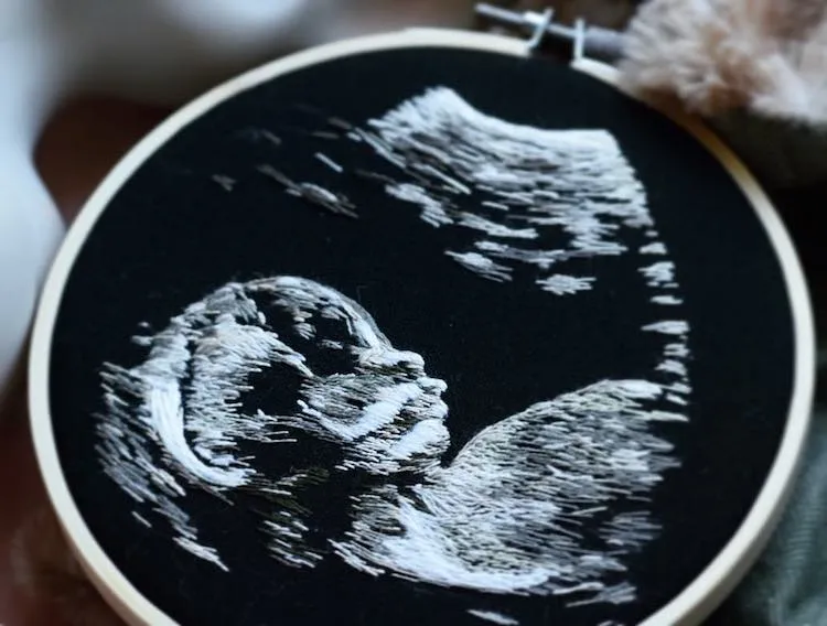 Des broderies d'échographies Des broderies d echographies bebe ultrason 8 Des-broderies-d-echographies-bebe-ultrason