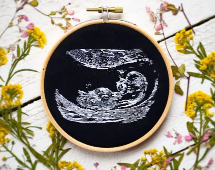 Des broderies d'échographies Des broderies d echographies bebe ultrason 9 Des-broderies-d-echographies-bebe-ultrason