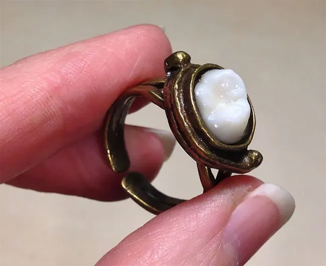 Des bijoux en dents humaines Des bijoux en dents humaines pendentif collier bague couble oreille bracelet dent 14 Des-bijoux-en-dents-humaines-pendentif-collier-bague-couble-oreille-bracelet-dent