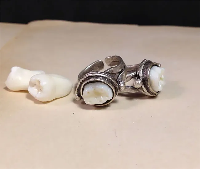 Des bijoux en dents humaines Des bijoux en dents humaines pendentif collier bague couble oreille bracelet dent 15 Des-bijoux-en-dents-humaines-pendentif-collier-bague-couble-oreille-bracelet-dent