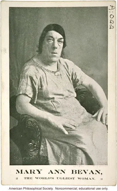 Mary Ann Bevan, la femme la plus laide du monde dans les années 1920 Mary Ann Bevan connue pour etre la femme la plus laide du monde dans les annees 1920 2 Mary-Ann-Bevan-connue-pour-etre-la-femme-la-plus-laide-du-monde-dans-les-annees-1920-2