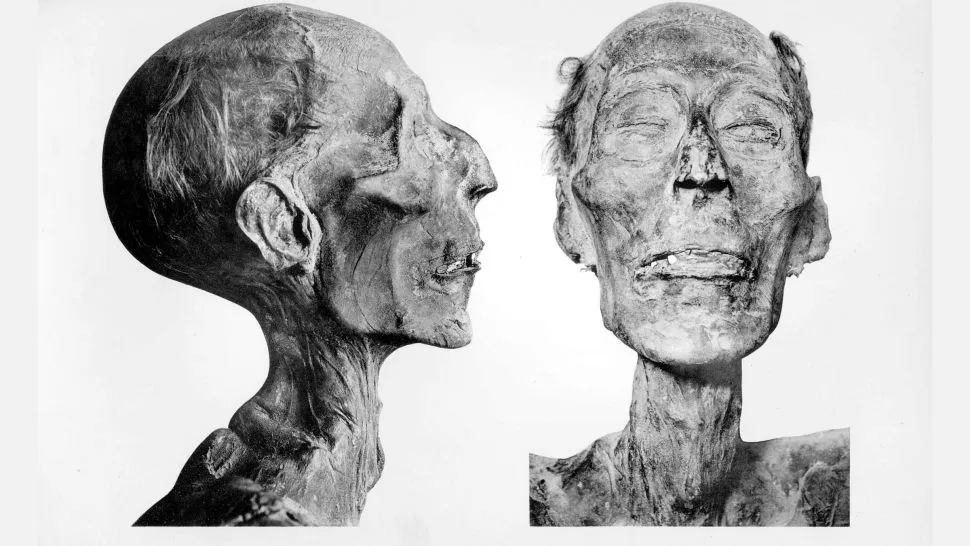 Une reconstitution du visage de Ramsès II par tomodensitométrie une reconstitution du visage de ramses ii par tomodensitometrie momie de ramses une-reconstitution-du-visage-de-ramses-ii-par-tomodensitometrie-momie-de-ramses