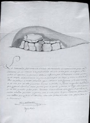 Schéma historique de 1832 montrant le dolmen d’Aizkomendi dans son état ancien Schéma historique de 1832 montrant le dolmen d’Aizkomendi dans son état ancien