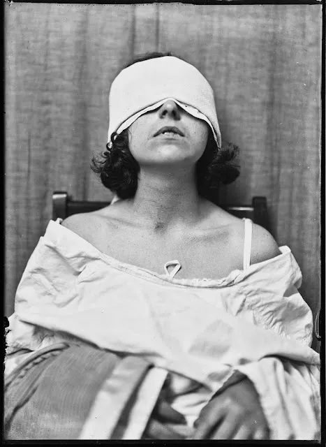 Quelques portraits des patients du Dr Harvey Cushing au début du XXème siècle quelques portraits des patients du dr harvey cushing au debut du xxeme siecle 10 quelques-portraits-des-patients-du-dr-harvey-cushing-au-debut-du-xxeme-siecle-10