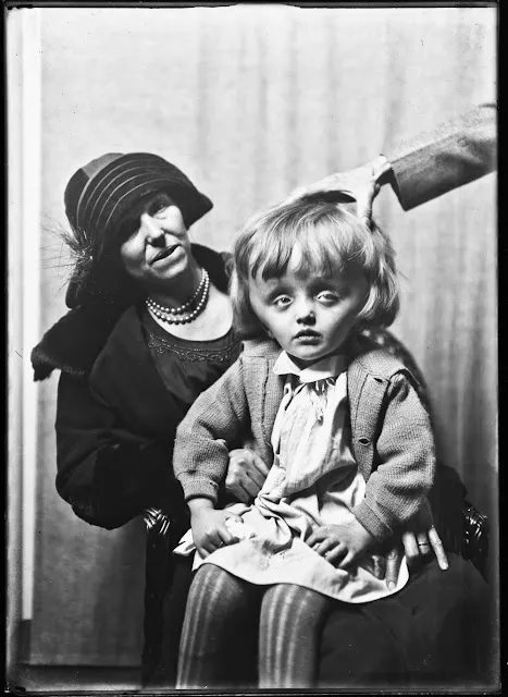 Quelques portraits des patients du Dr Harvey Cushing au début du XXème siècle quelques portraits des patients du dr harvey cushing au debut du xxeme siecle 11 quelques-portraits-des-patients-du-dr-harvey-cushing-au-debut-du-xxeme-siecle-11