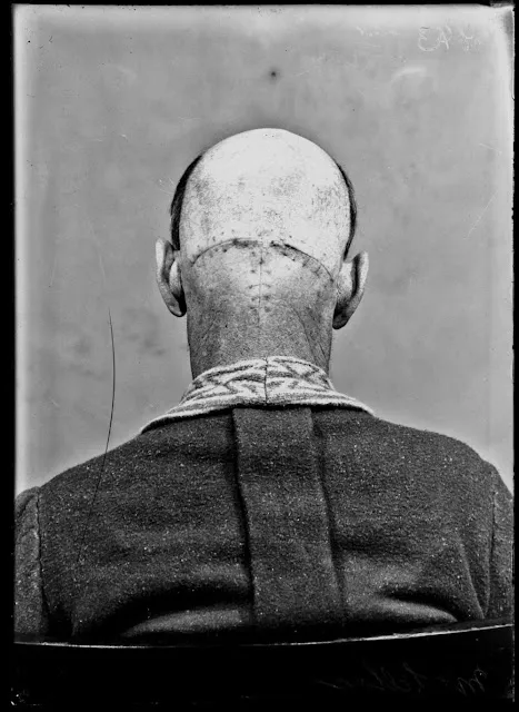 Quelques portraits des patients du Dr Harvey Cushing au début du XXème siècle quelques portraits des patients du dr harvey cushing au debut du xxeme siecle 2 quelques-portraits-des-patients-du-dr-harvey-cushing-au-debut-du-xxeme-siecle-2