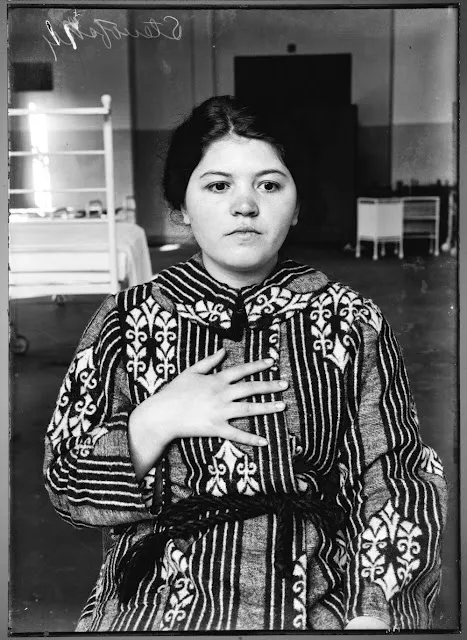 Quelques portraits des patients du Dr Harvey Cushing au début du XXème siècle quelques portraits des patients du dr harvey cushing au debut du xxeme siecle 20 quelques-portraits-des-patients-du-dr-harvey-cushing-au-debut-du-xxeme-siecle-20