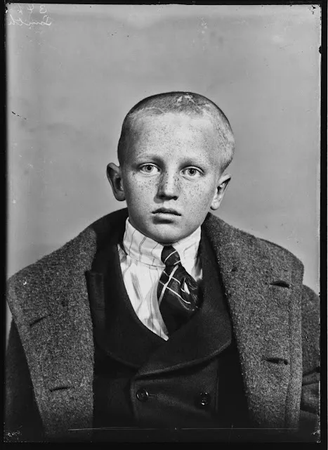 Quelques portraits des patients du Dr Harvey Cushing au début du XXème siècle quelques portraits des patients du dr harvey cushing au debut du xxeme siecle 5 quelques-portraits-des-patients-du-dr-harvey-cushing-au-debut-du-xxeme-siecle-5