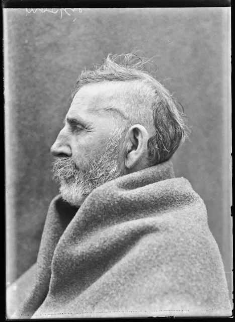 Quelques portraits des patients du Dr Harvey Cushing au début du XXème siècle quelques portraits des patients du dr harvey cushing au debut du xxeme siecle 7 quelques-portraits-des-patients-du-dr-harvey-cushing-au-debut-du-xxeme-siecle-7