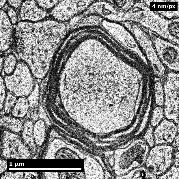 Axone myélinisé dans le cortex humain Axone myélinisé observé dans un fragment de cortex humain du projet H01