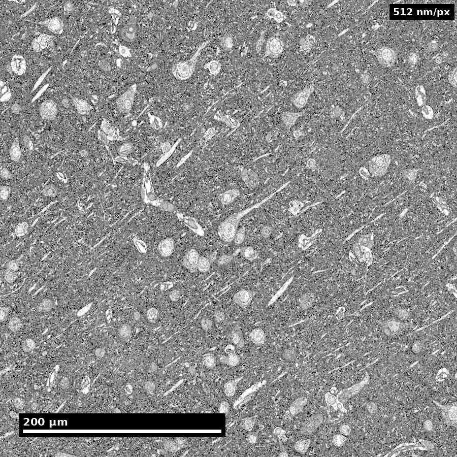 Cellules et vaisseaux du cortex humain Cellules et vaisseaux sanguins dans un fragment de cortex humain du projet H01