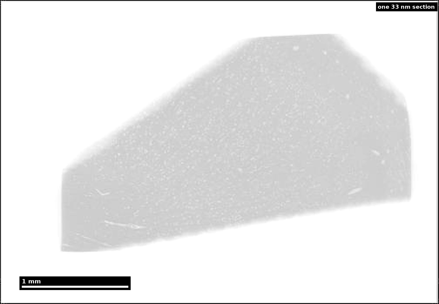 fragment cortex humain h01 ALT : Fragment de cortex temporal humain reconstruit en 3D dans le projet H01