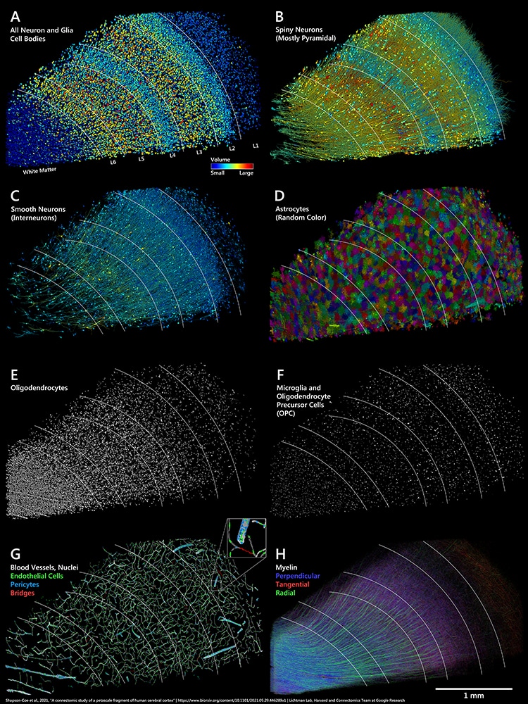 Google et Harvard publient la carte du cerveau humain la plus détaillée à ce jour google et harvard publient la carte du cerveau humain la plus detaillee a ce jour 2 google-et-harvard-publient-la-carte-du-cerveau-humain-la-plus-detaillee-a-ce-jour-3