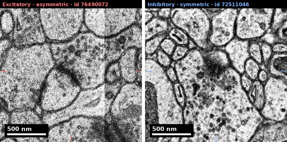 ynapses du cortex humain à l’échelle nanométrique Synapses observées à l’échelle nanométrique dans le cortex humain du projet H01
